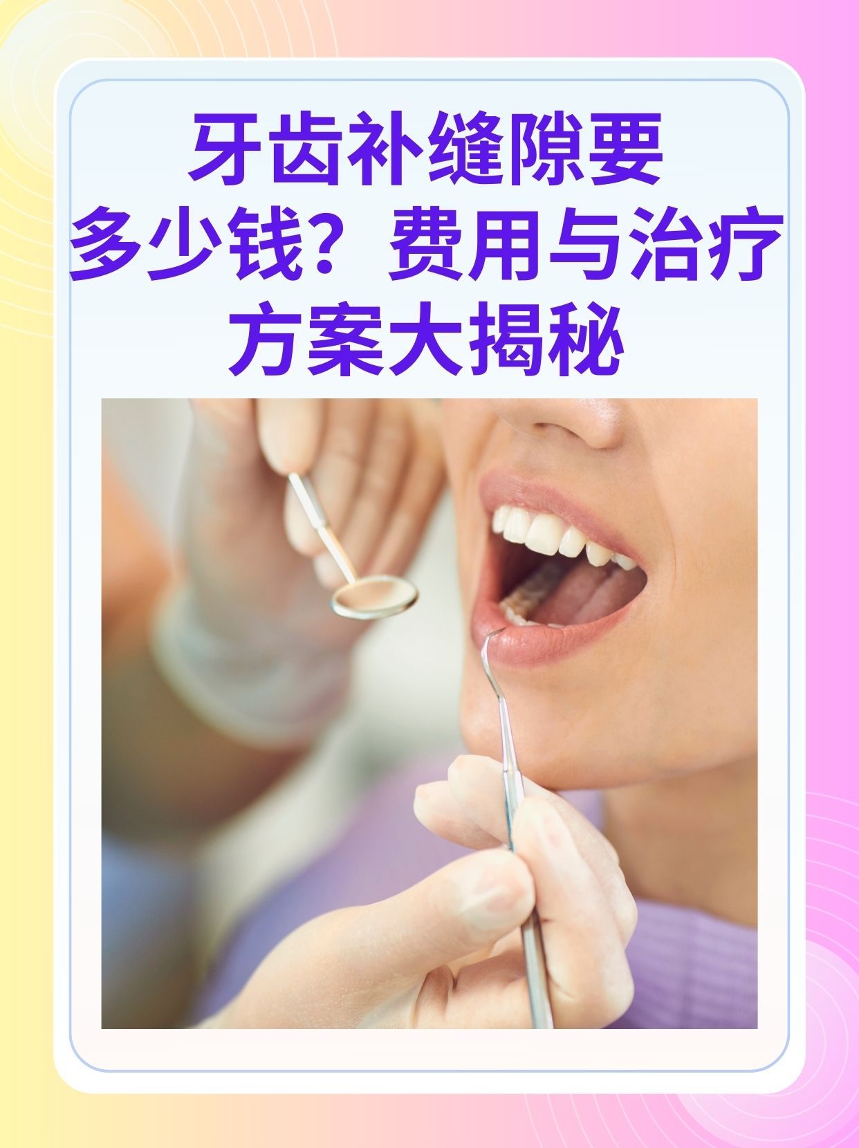 泰安补牙医保可以报销吗(补牙医保可以报销吗 哪些可以报销呢)