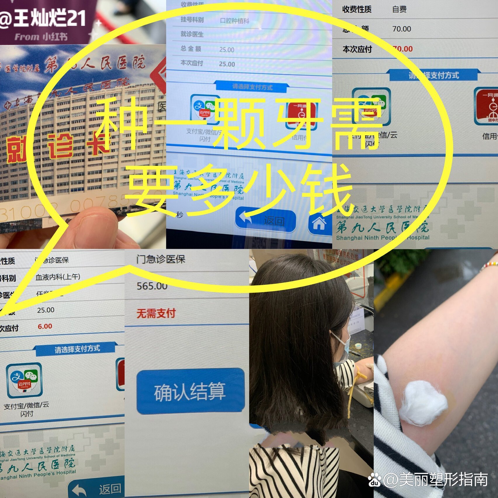 看牙可以用医保卡吗(看牙可以用医保卡里的钱缴费吗) 看牙可以用医保卡吗(看牙可以用医保卡里的钱缴费吗)